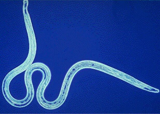 Nematodes in the human body