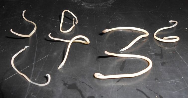 Worms from the body of an adult