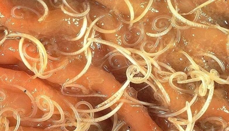 Worms from the human body