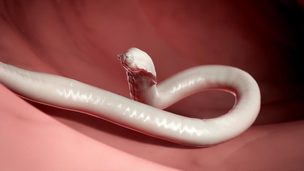 Worm from the human body