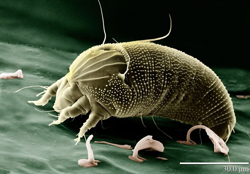 scabies mite