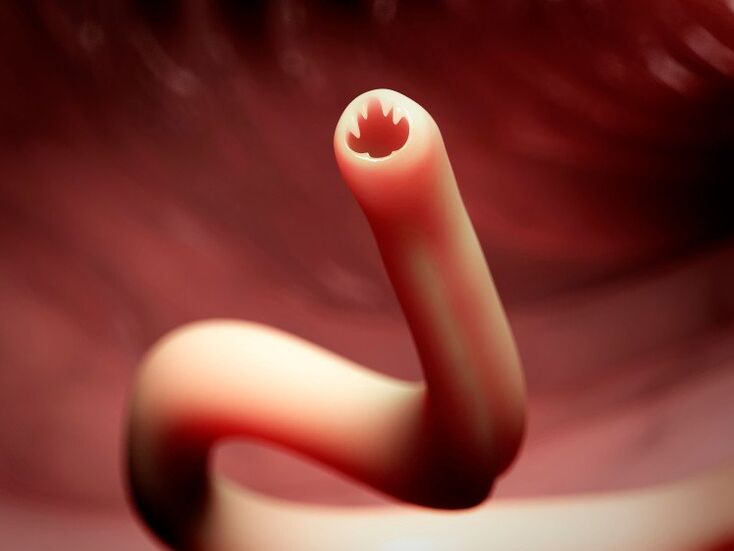 Worm in the human body